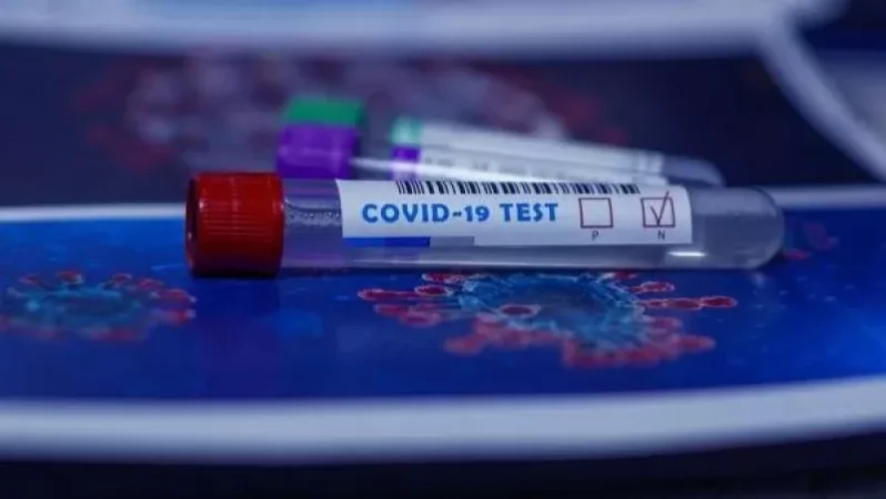 Հայաստանում հաստատվել է կորոնավիրուսով վարակվելու 1098 նոր դեպք