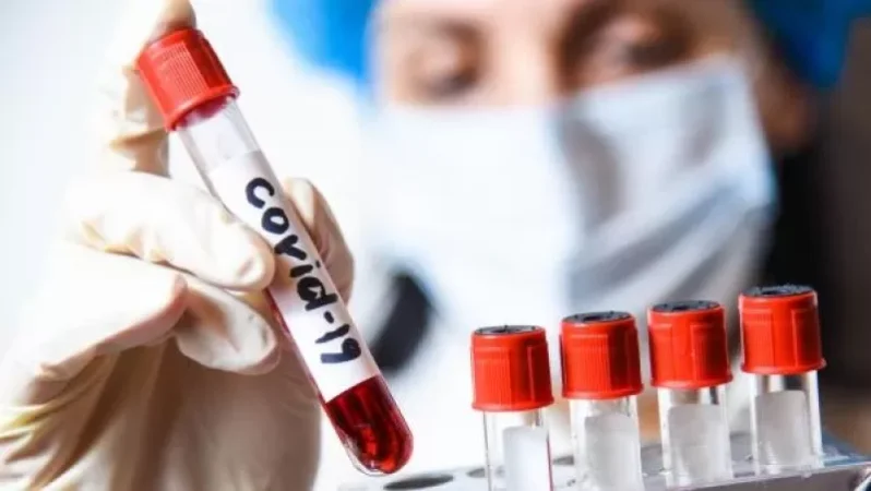 Հայաստանում հաստատվել է կորոնավիրուսով վարակվելու 172. ունենք 171 առողջացած