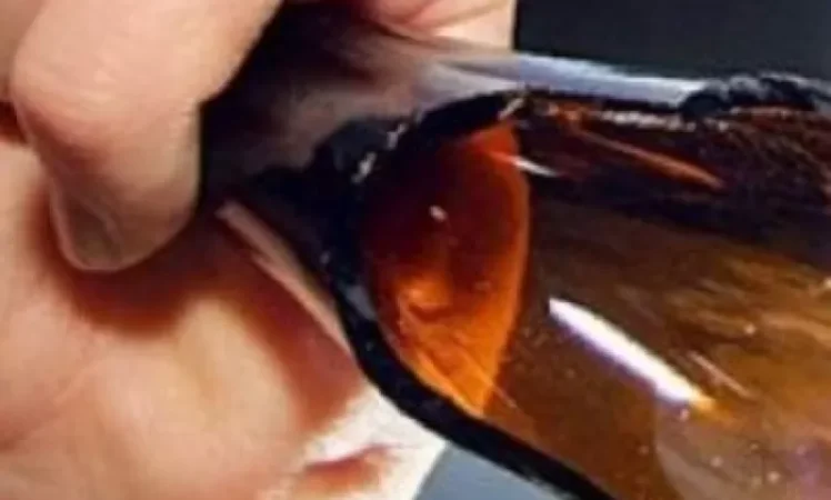 Երիտասարդին մեղադրանք է առաջադրվել բարմենին շշով հարվածելու և  ծանր վնաս պատճառելու համար