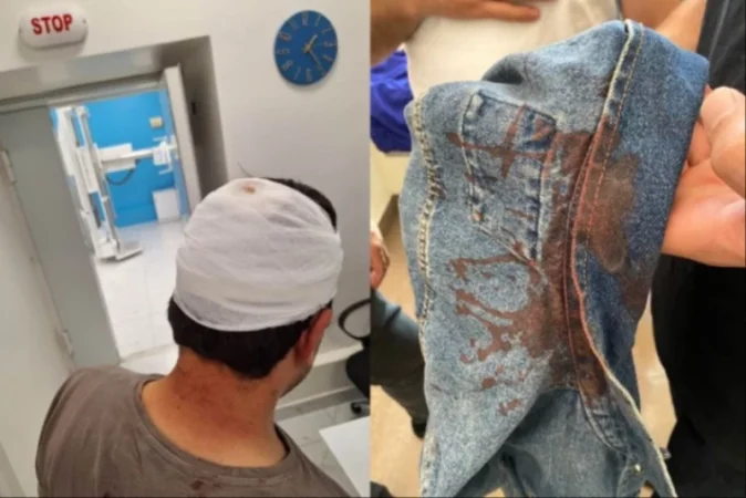 ԼՈՒՍԱՆԿԱՐՆԵՐ․ Բերետավորները դուրս էին քաշել մեքենայից, գետնին գցած բազմաթիվ հարվածներ էին հասցրել․ պատգամավոր