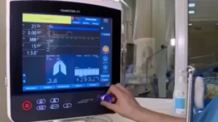 ՏԵՍԱՆՅՈՒԹ. Հայկական ընկերությունը թոքերի արհեստական օդափոխման համակարգեր արտադրելու լիցենզիա է ստացել