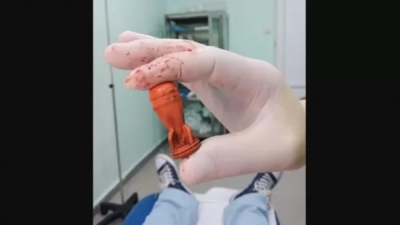 Լրագրողի ոտքից հանված ռետինե փամփուշտ. Վրաստանում վիրավորվել է ավելի քան 12 լրագրող. Shantnews