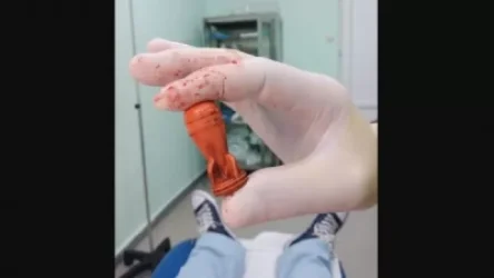 Լրագրողի ոտքից հանված ռետինե փամփուշտ. Վրաստանում վիրավորվել է ավելի քան 12 լրագրող. Shantnews