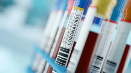 ՀՀ մուտք գործելիս COVID-19-ի բացասական թեստը պետք է առավելագույնը 72 ժամ վաղեմության լինի