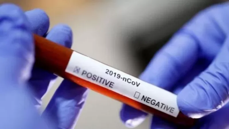 Հաստատվել է կորոնավիրուսի 549 նոր դեպք, առողջացել 881 քաղաքացի