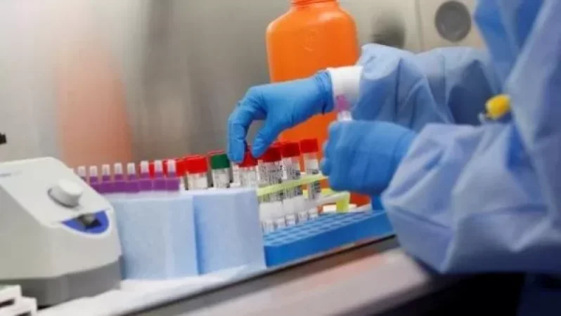 Հայաստանում հաստատվել է կորոնավիրուսով վարակվելու 1520 նոր դեպք