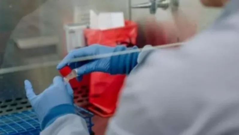 ՀՀ-ում կորոնավիրուսի 813 նոր դեպք է հաստատվել