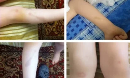 Մանկապարտեզում  դաստիարակը բռնության է ենթարկել 3.5 տարեկան երեխային․ 168. am