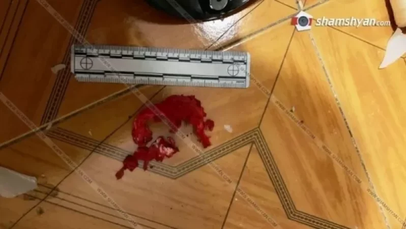 Դանակահարություն Երևանում. ամուսինը դանակով հարվածել է իր կնոջը և օգնության եկած հարևանին