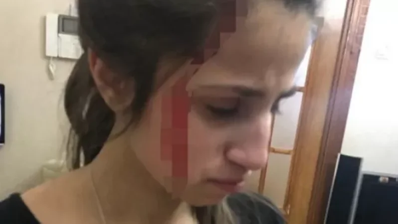 Նոր ապացույցներ. Խաչատուրյան քույրերը պարբերաբար ծեծի են ենթարկվել հոր կողմից