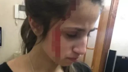 Նոր ապացույցներ. Խաչատուրյան քույրերը պարբերաբար ծեծի են ենթարկվել հոր կողմից