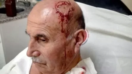 Թուրքիայում  քուրդ տղամարդը դաժան ծեծի է ենթարկվել՝ իր կնոջ հետ քրդերեն խոսելու համար