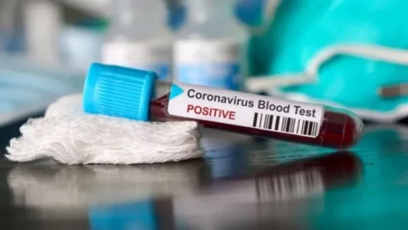 Հայաստանում այսօր հաստատվել է կորոնավիրուսով վարակվելու 920 դեպք