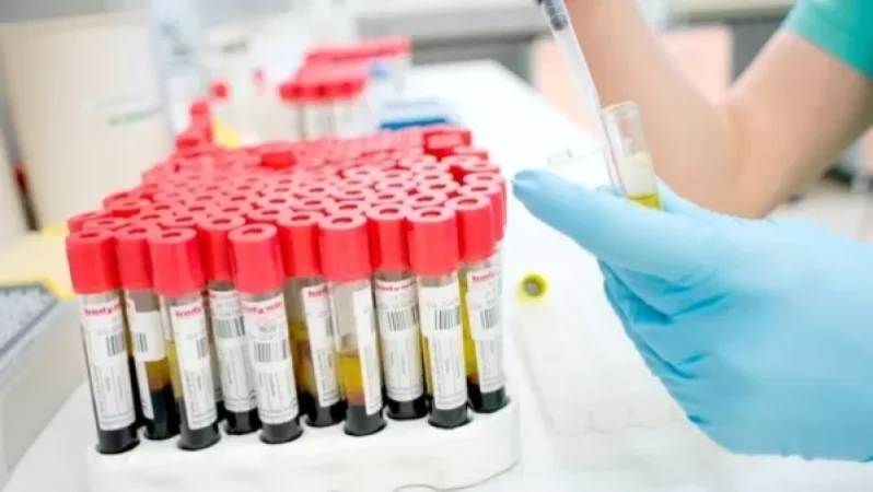 Անասնաբույժը 1 կենդանուց վերցված արյունը ախտորոշման է ներկայացրել 91-ի փոխարեն