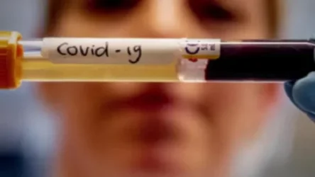 Հայաստանում հաստատվել է կորոնավիրուսով վարակվելու 586 նոր դեպք. մահացել է 19 մարդ