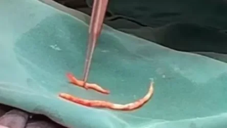 ՏԵՍԱՆՅՈՒԹ. Լսե՛ք սրտային վիրաբույժի կարծիքը. ծխախոտի վնասակար ազդեցությունը. Արսեն Թորոսյան