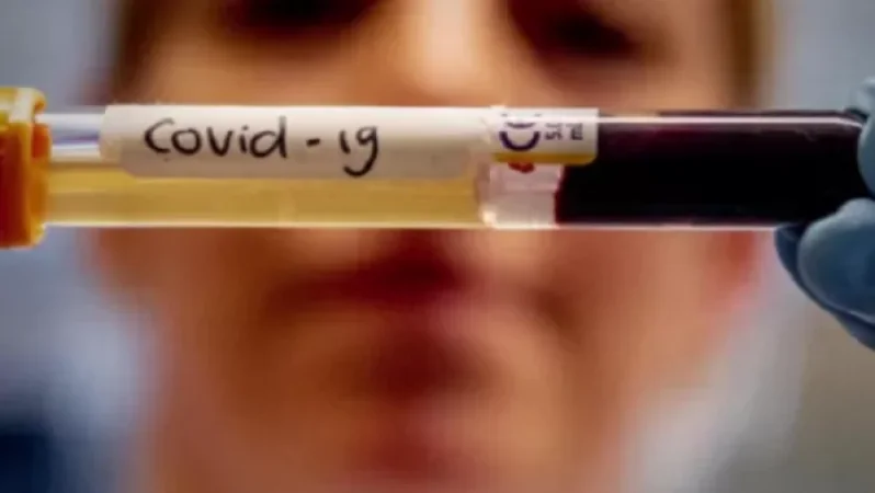 448 նոր դեպք, 12 մահ` մեկ օրում. կորոնավիրուսային հիվանդության թարմացված տվյալները