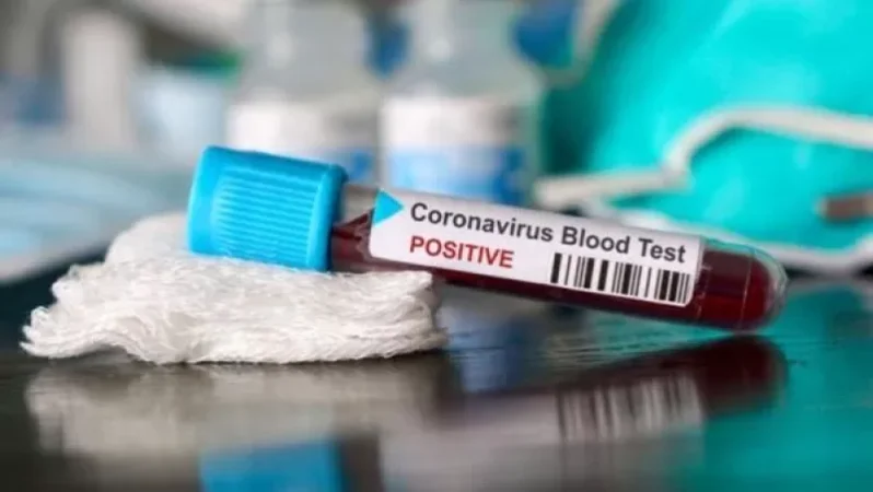 Հայաստանում հաստատվել է կորոնավիրուսով վարակվելու 263 նոր դեպք. մահացել է 13 մարդ