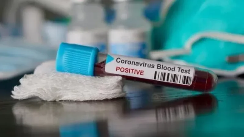 Արցախում կորոնավիրուսի նոր դեպքեր են հայտնաբերվել