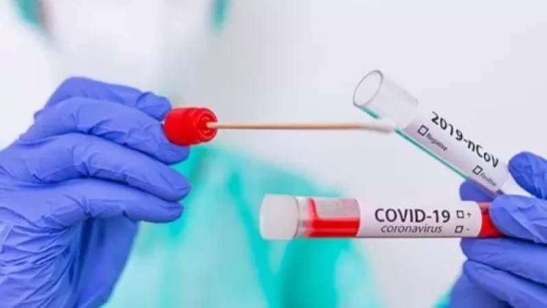 236 նոր դեպք, 9 մահ` մեկ օրում. կորոնավիրուսային հիվանդության ընթացքը Հայաստանում