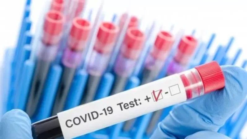 Հայաստանում հաստատվել է կորոնավիրուսով վարակվելու 183, մահվան՝ 11 նոր դեպք