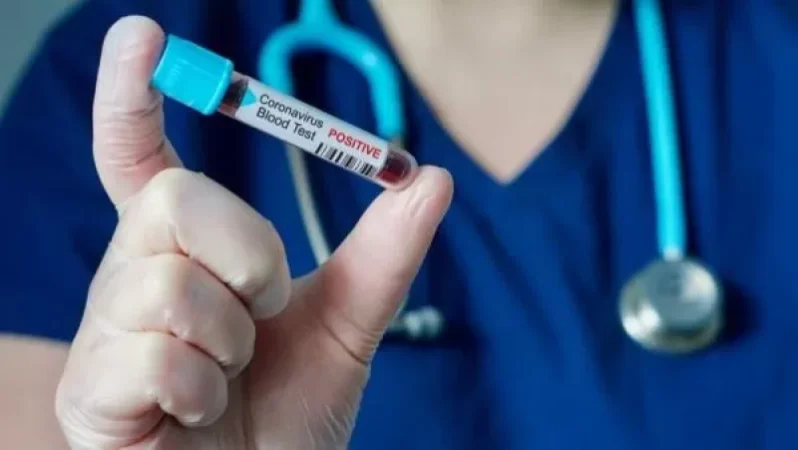 138 նոր դեպք, 5 մահ` մեկ օրում. կորոնավիրուսային հիվանդության ընթացքը Հայաստանում