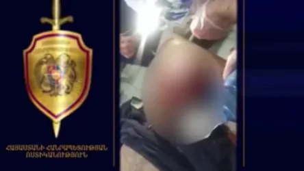 ՏԵՍԱՆՅՈՒԹ. Կինը ձողով հարվածել է տղամարդու գլխին, վերջինը մահացել է