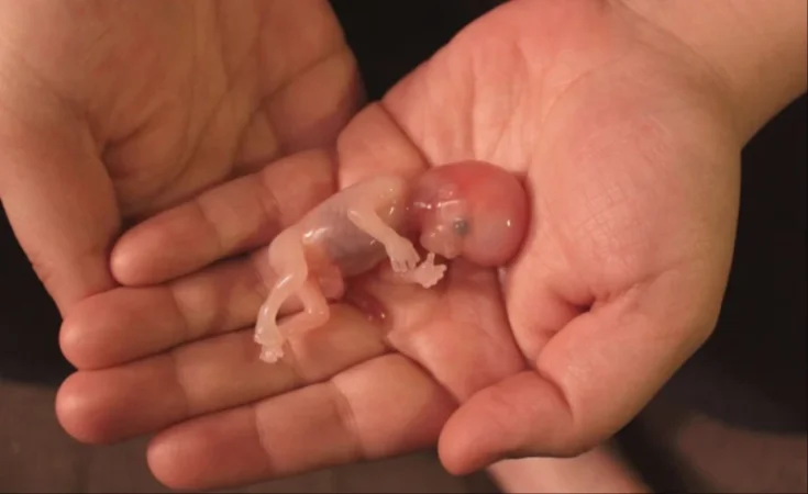 ՔՊ-ականները որոշել են հեշտացնել  աբորտը. «Ժողովուրդ»