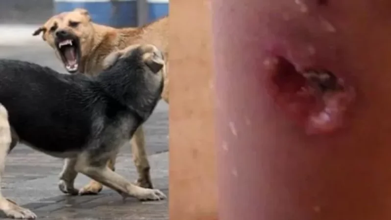 Թափառող շները վնասվածքներ են հասցրել երեխաներին. Շերամի փողոցի բնակիչներն ահազանգում են