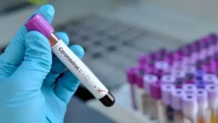 Կորոնավիրուսային հիվանդության այսօրվա տվյալները