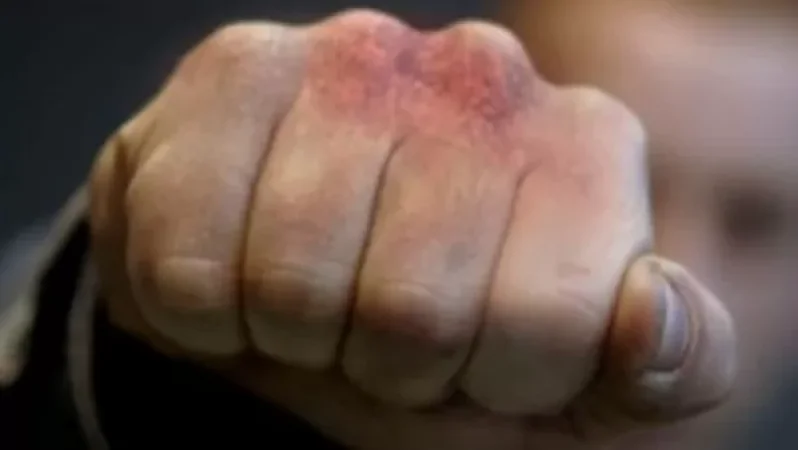 Քադիրովի ներկայացուցչի օգնականն իր ոստիկան ընկերոջ հետ ծեծի է ենթարկել ադրբեջանցուն և առևանգել նրա մեքենան