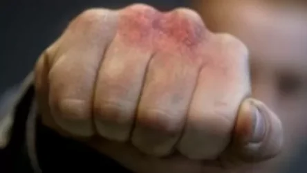 Քադիրովի ներկայացուցչի օգնականն իր ոստիկան ընկերոջ հետ ծեծի է ենթարկել ադրբեջանցուն և առևանգել նրա մեքենան