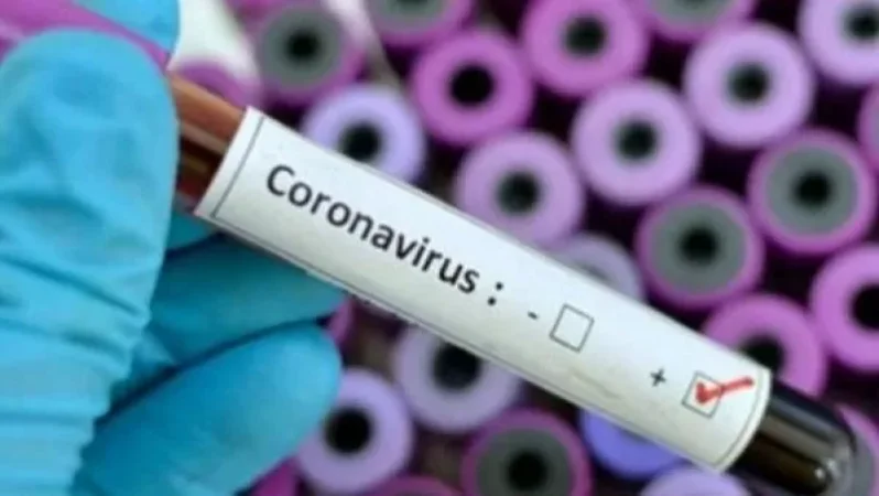 Urgent: 2 More Cases of Coronavirus Registered in Armenia - Arsen Torosyan