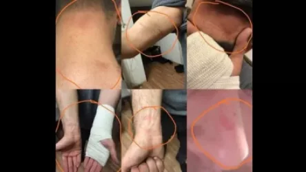 «Ոստիկանությունում պաշտպանյալիս դաժան ծեծի են ենթարկել». Ալեքսանդր Կոչուբաև