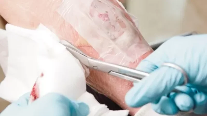 41-ամյա տղամարդը բակում պայթյունի հետևանքով վնասվածքներ է ստացել