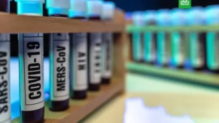 Արմեն Սարգսյանն առաջարկել է ՀՀ-ում կորոնավիրուսի բուժման համար թոքերի պարզագույն օդափոխիչներ ստեղծել 7 արտադրել