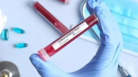 Կոտայքի մարզում մահացած 59-ամյա կնոջ ամուսնու ու որդու մոտ կորոնավիրուս է հաստատվել