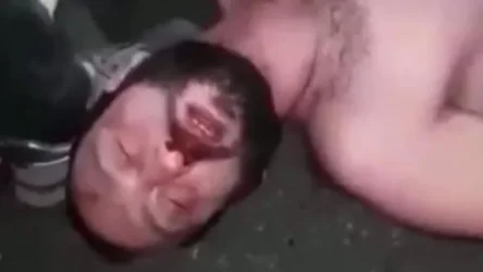 Արարատ Միրզոյանը ևս մեկ վիրահատության է ենթարկվել