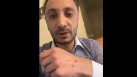 ՏԵՍԱՆՅՈՒԹ. Սրճարանում նախարար Հակոբ Արշակյանը հարձակվեց ինձ վրա, կոտրեց համակարգիչս. լրագրողն ահազանգում է