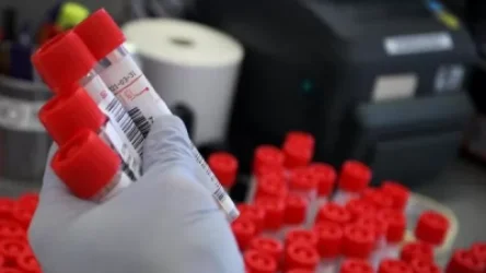 Հայաստանում կորոնավիրուսից ապաքինվել է 387 մարդ․ հաստատվել է վարակման 200 նոր դեպք