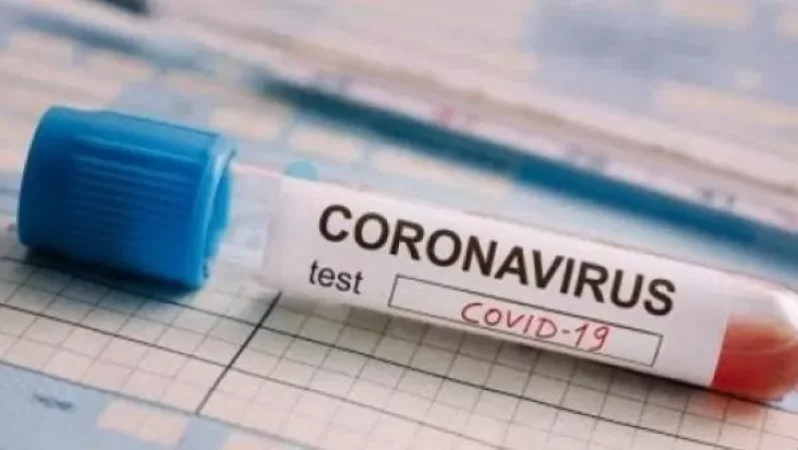 Հայաստանում հաստատվել է կորոնավիրուսով վարակվելու ռեկորդային՝ 460 դեպք , մահվան՝ 8 նոր դեպք