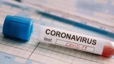 Հայաստանում հաստատվել է կորոնավիրուսով վարակվելու ռեկորդային՝ 460 դեպք , մահվան՝ 8 նոր դեպք