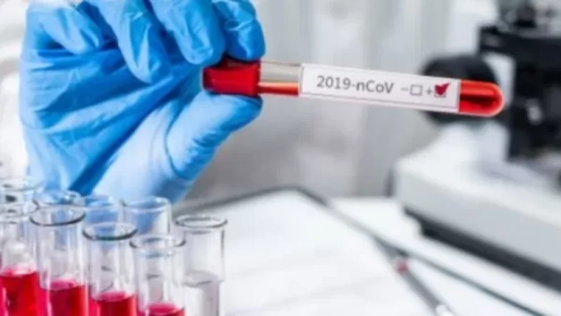 Սյունիքում կա COVID-ի 89 դեպք, 58-ը բուժվել է. 24 ասիմպտոմ վարակված մեկուսացված է տանը