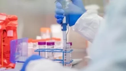 Հայաստանում կորոնավիրուսի 515 նոր դեպք է հաստատվել