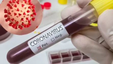 Հայաստանում հաստատվել է կորոնավիրուսով վարակվելու 590