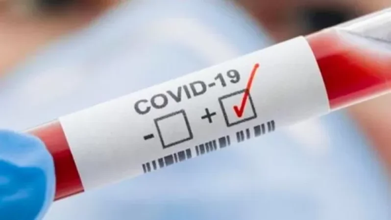 Հայաստանում այսօր հաստատվել է 663 նոր դեպք, ապաքինվել է 133 մարդ