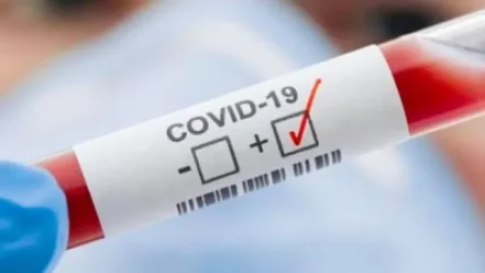 Հայաստանում այսօր հաստատվել է 663 նոր դեպք, ապաքինվել է 133 մարդ