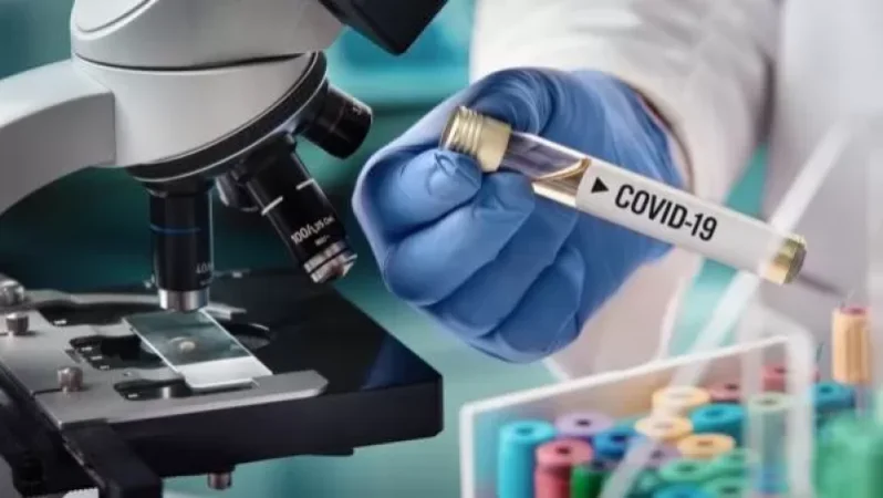 Կորոնավիրուսով վարակման 662 նոր դեպք. ապաքինվել է 762 անձ