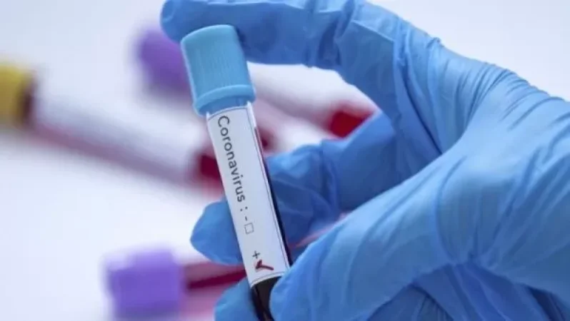 Ռուսաստանում կորոնավիրուսի 6791 նոր դեպք է գրանցվել