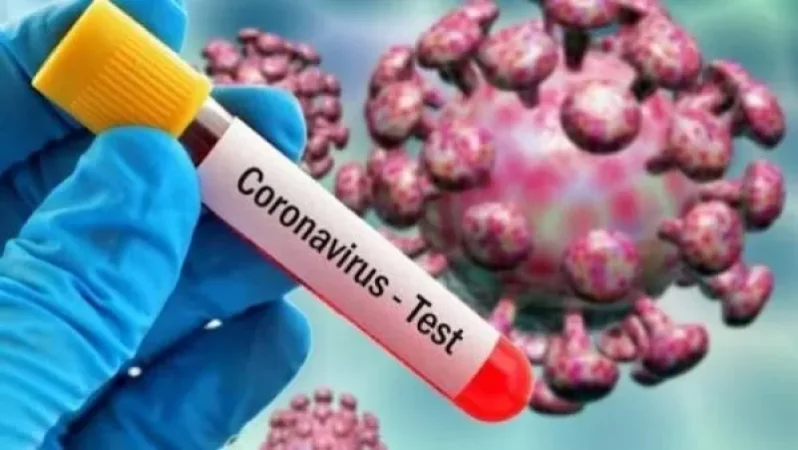 Գեղարքունիքի մարզում հաստատվել է կորոնավիրուսային հիվանդության 27 նոր դեպք